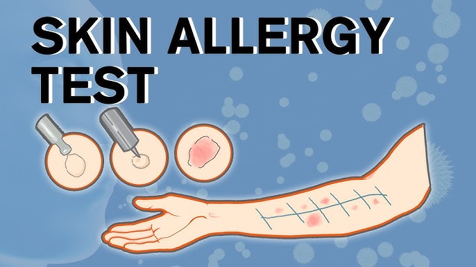 Allergy Testing Clinic in Nagpur
